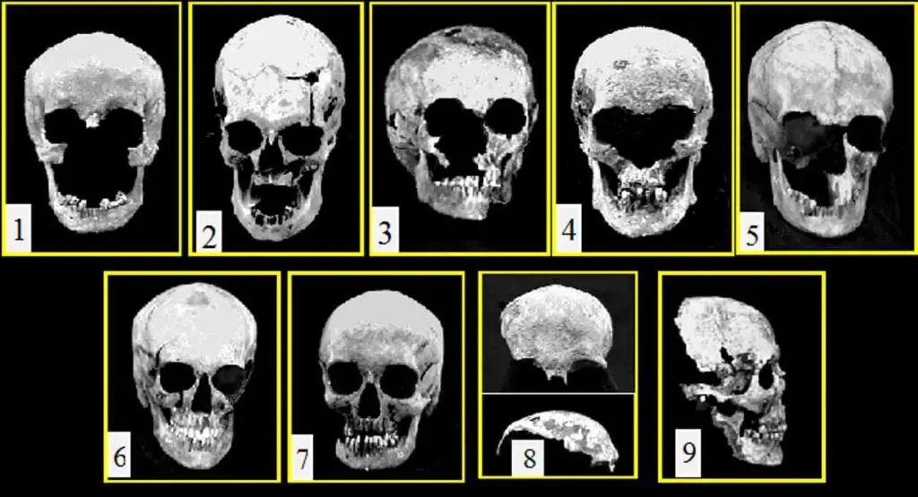 x-rays of Romanov's skulls